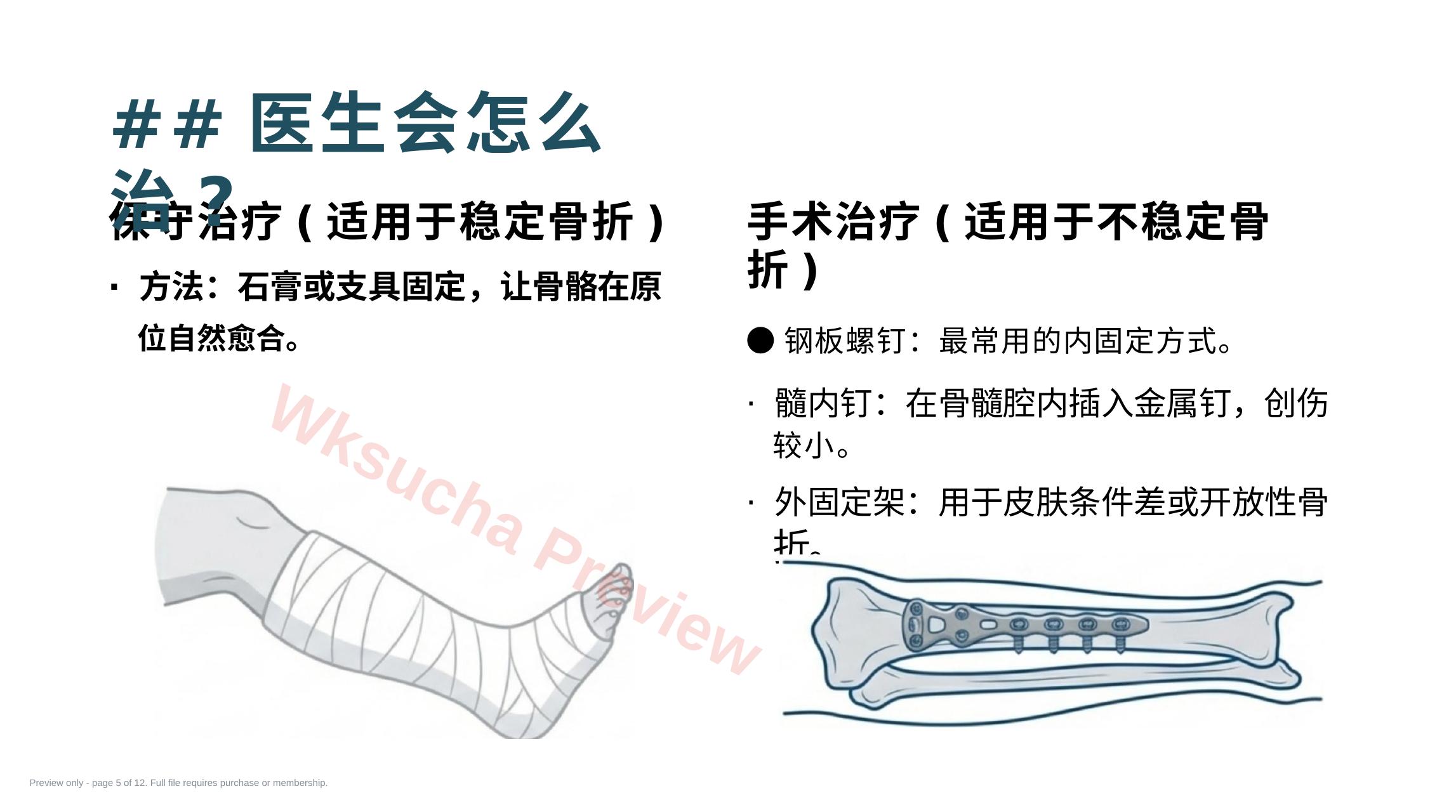 预览第 5 页