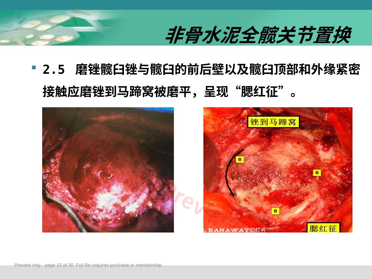 预览第 15 页