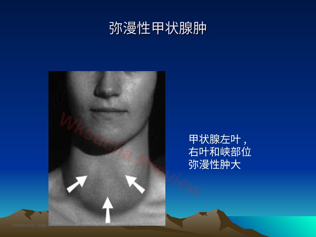 预览第 17 页