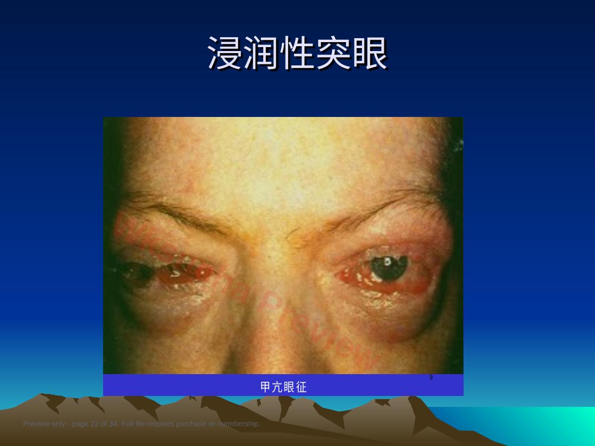 预览第 22 页