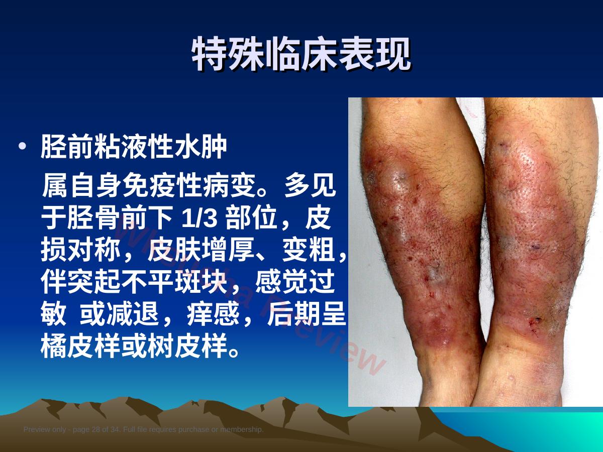 预览第 28 页