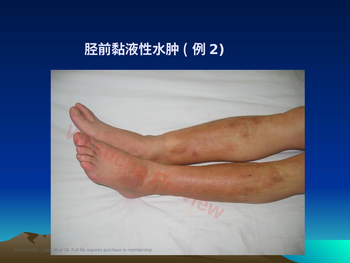 预览第 30 页
