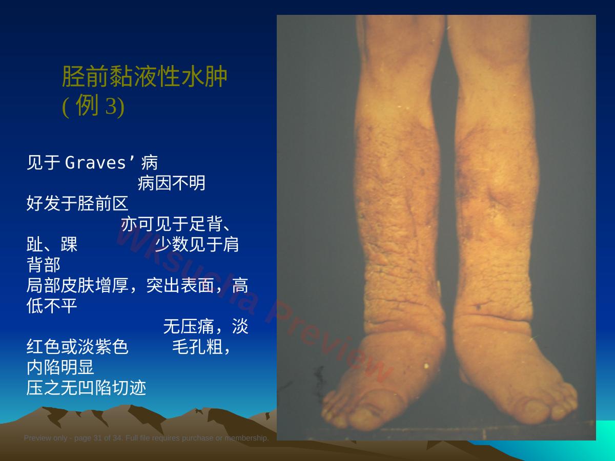 预览第 31 页