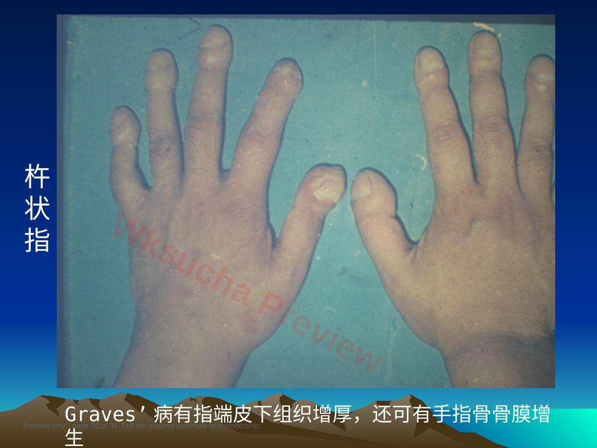 预览第 32 页