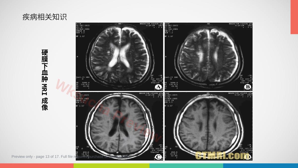 预览第 13 页