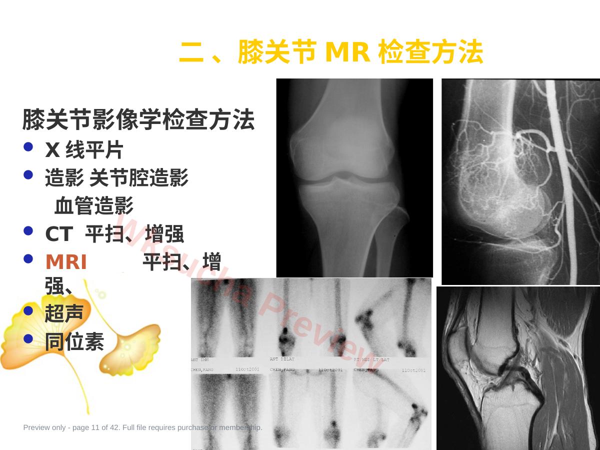 预览第 11 页