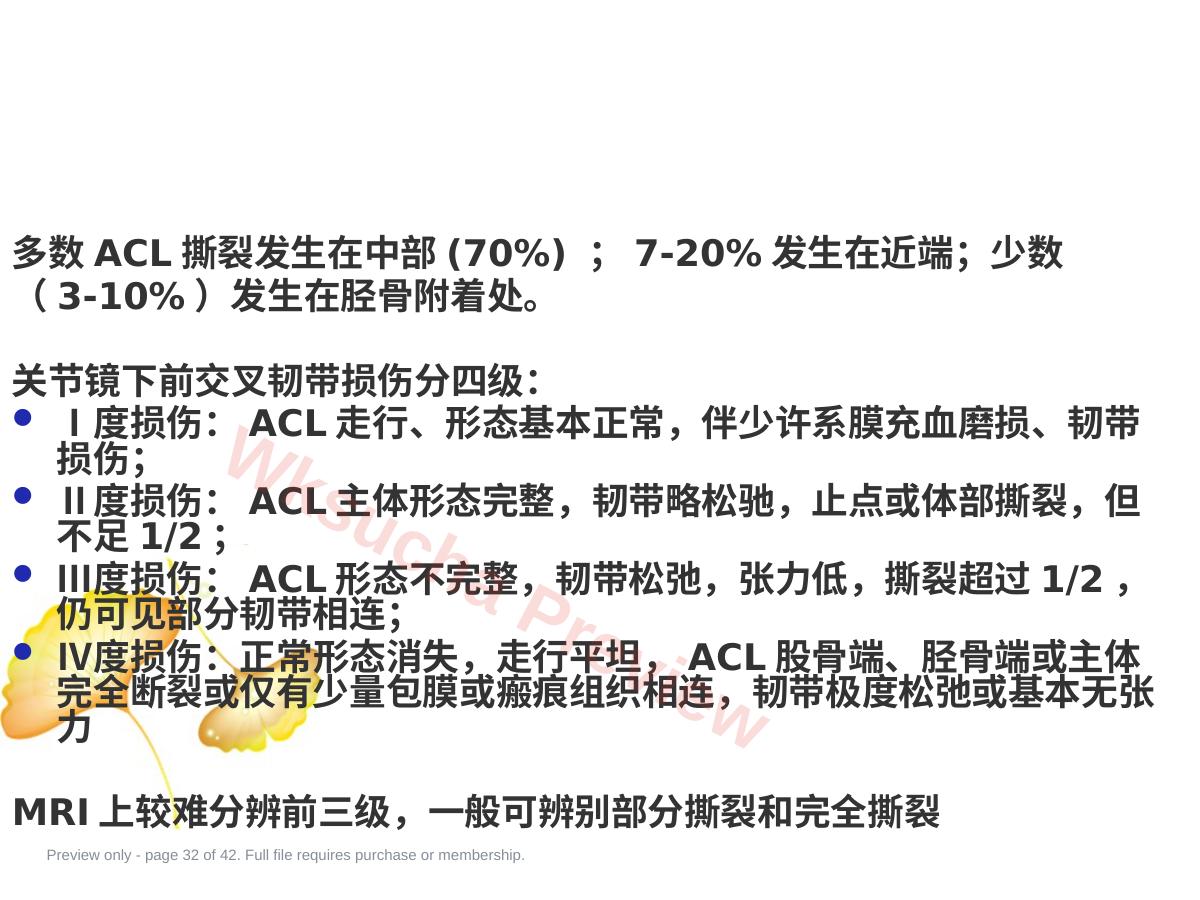 预览第 32 页