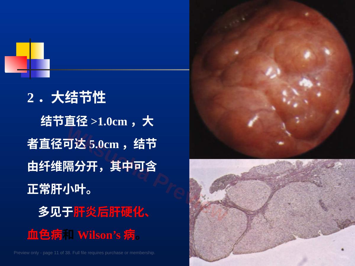 预览第 11 页