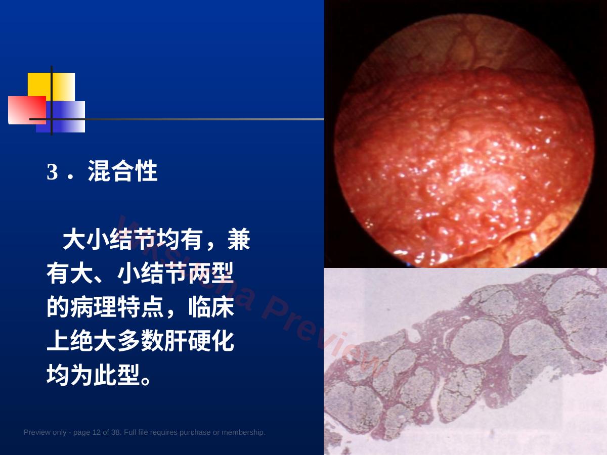 预览第 12 页