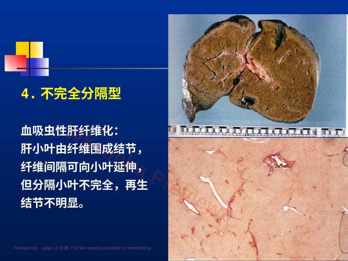 预览第 13 页