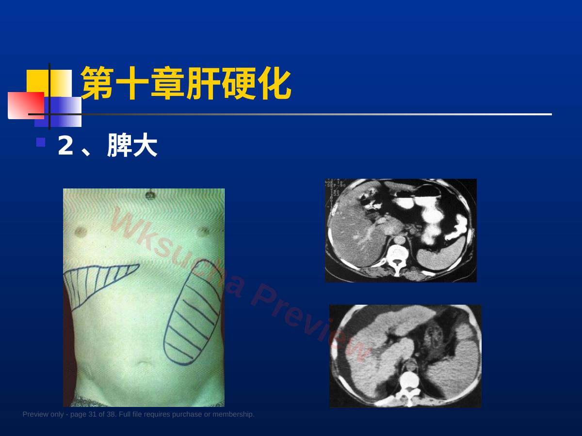 预览第 31 页