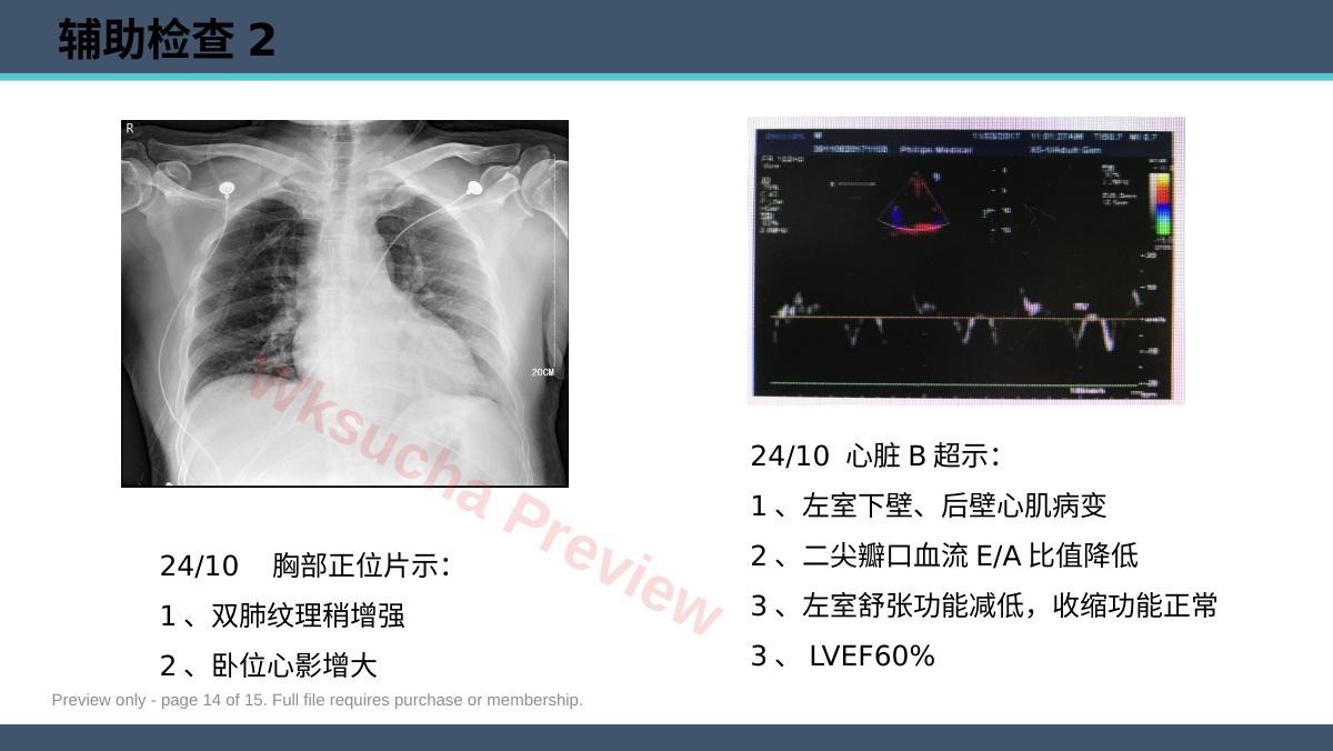 预览第 14 页