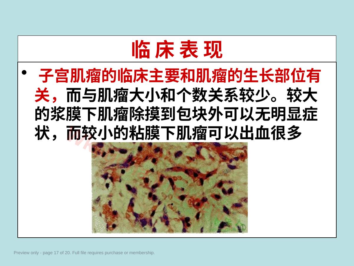 预览第 17 页