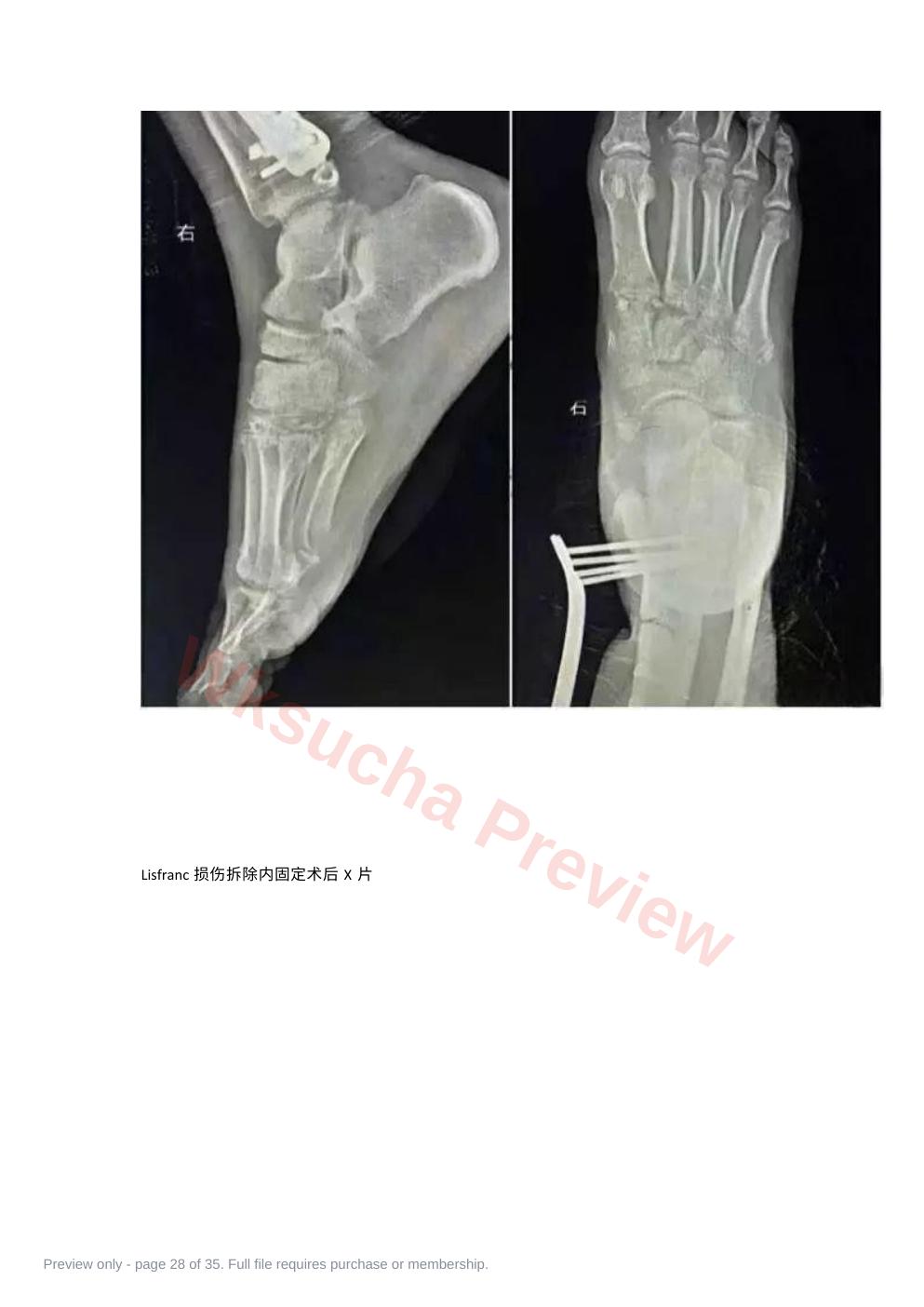 预览第 28 页