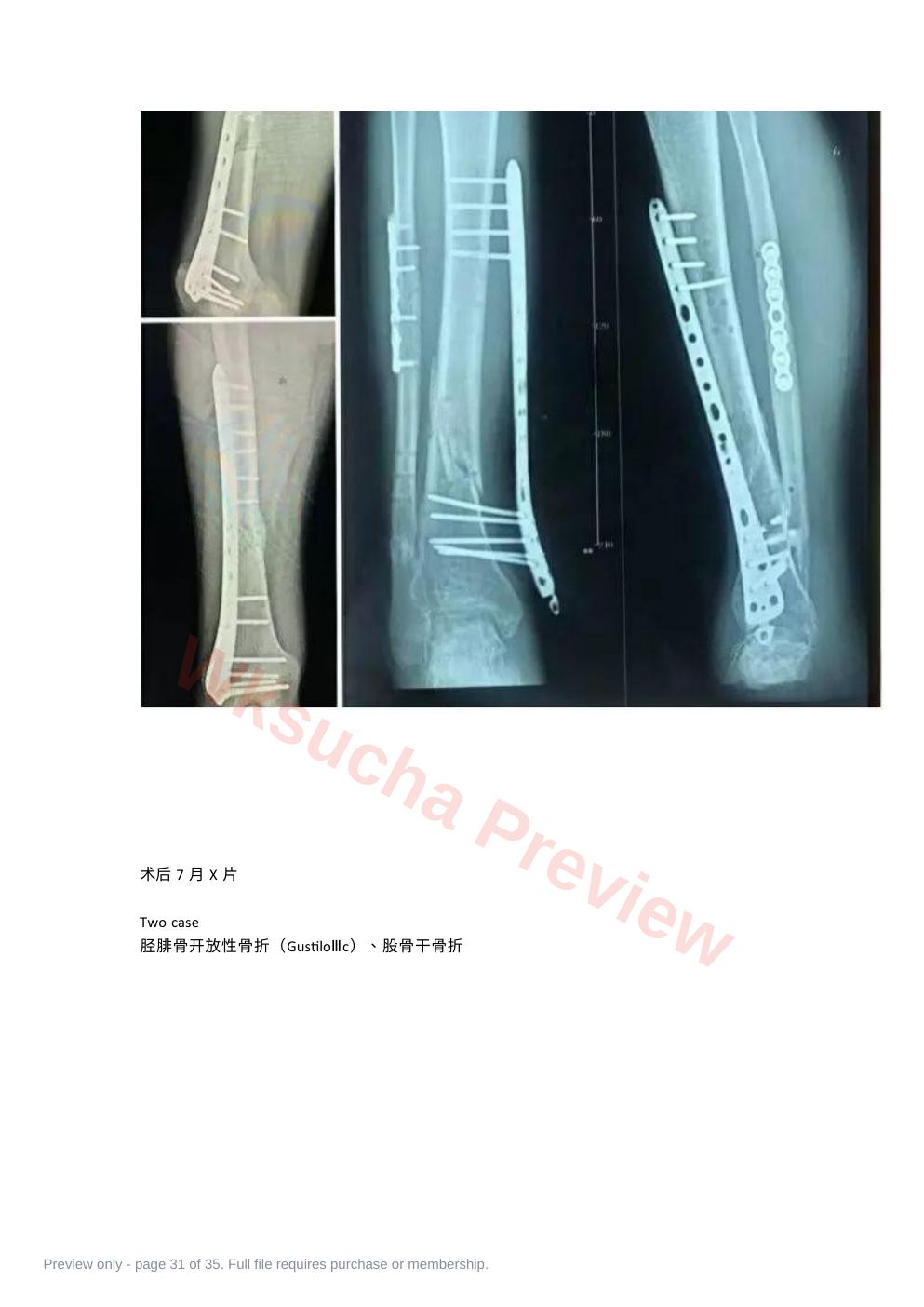 预览第 31 页