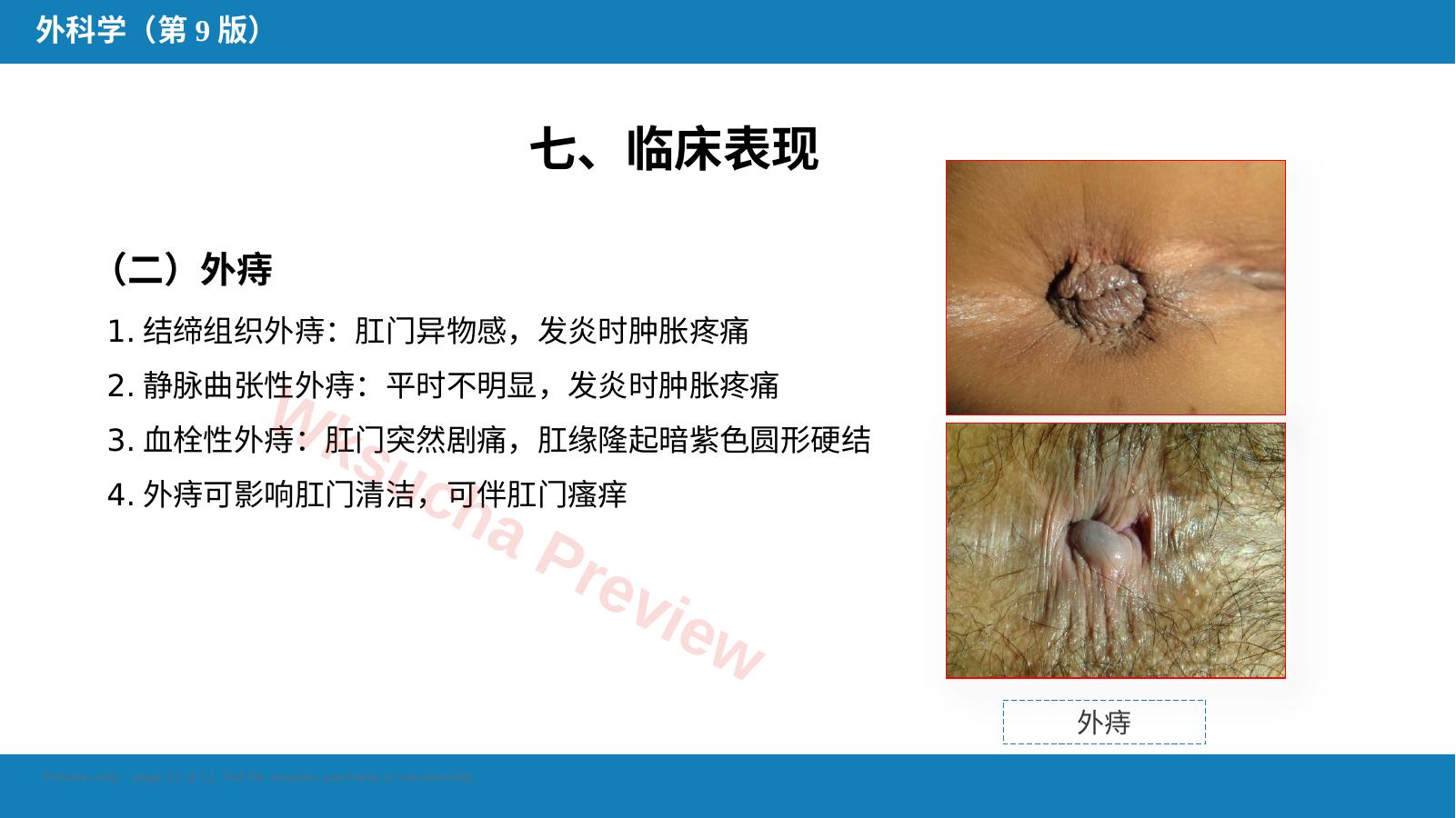 预览第 11 页