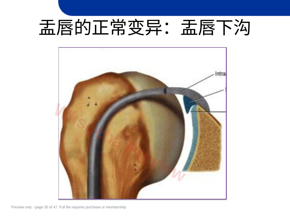 预览第 35 页
