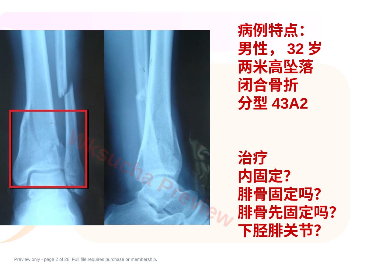 预览第 2 页