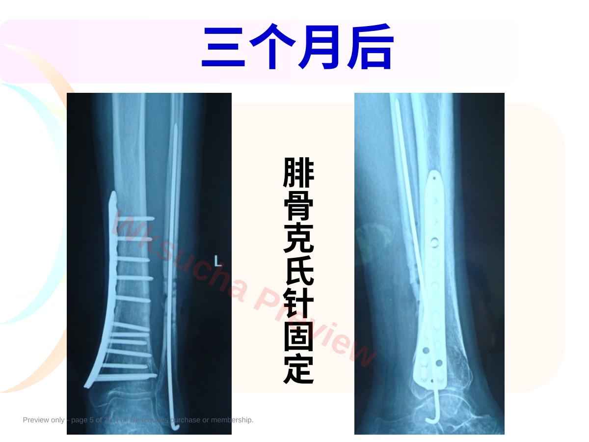 预览第 5 页