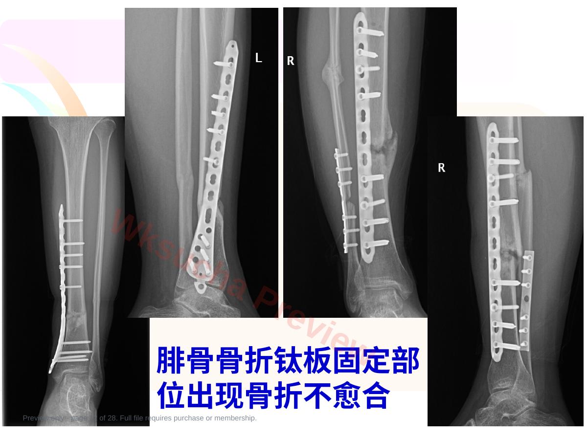 预览第 12 页