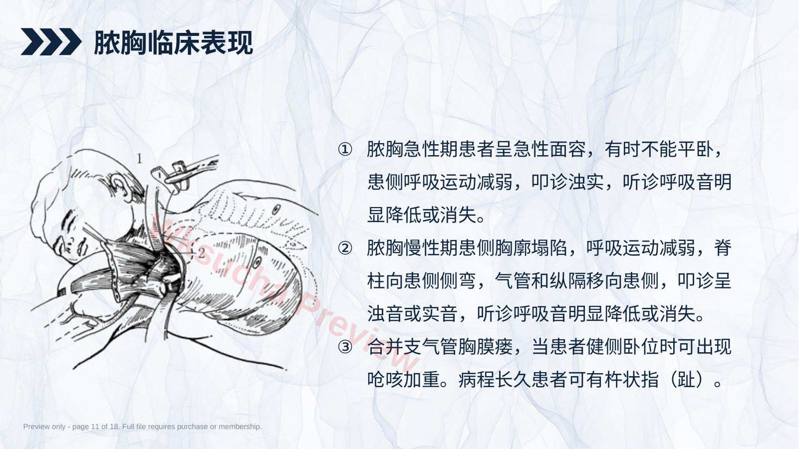预览第 11 页