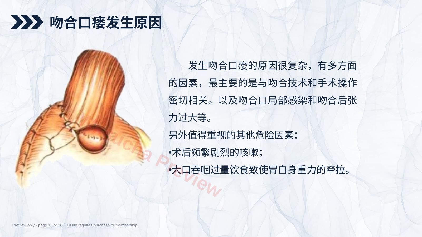 预览第 13 页