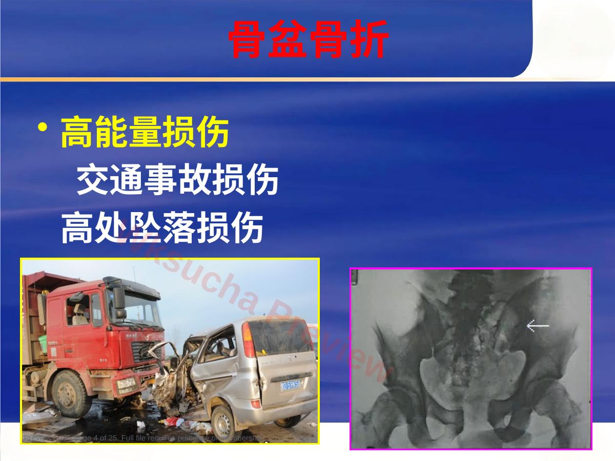 预览第 4 页