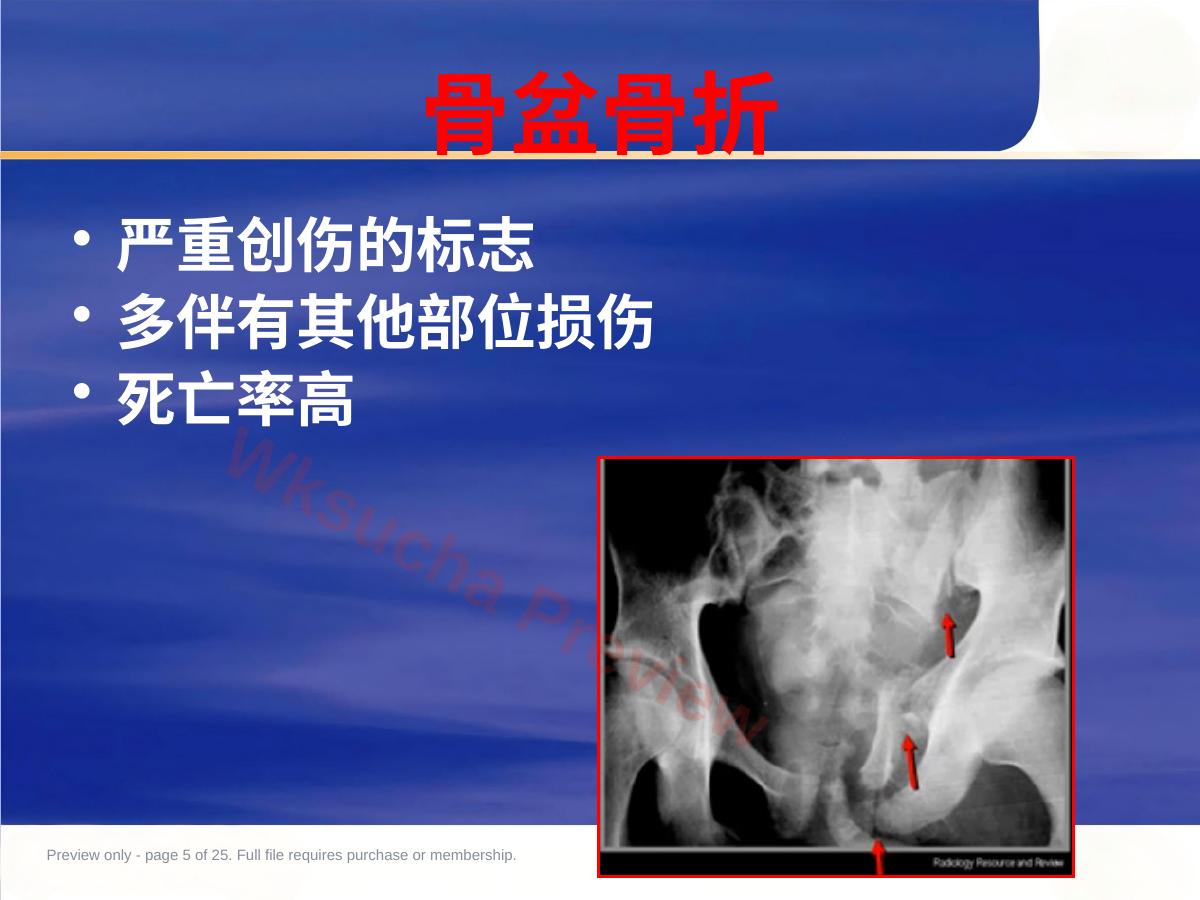 预览第 5 页