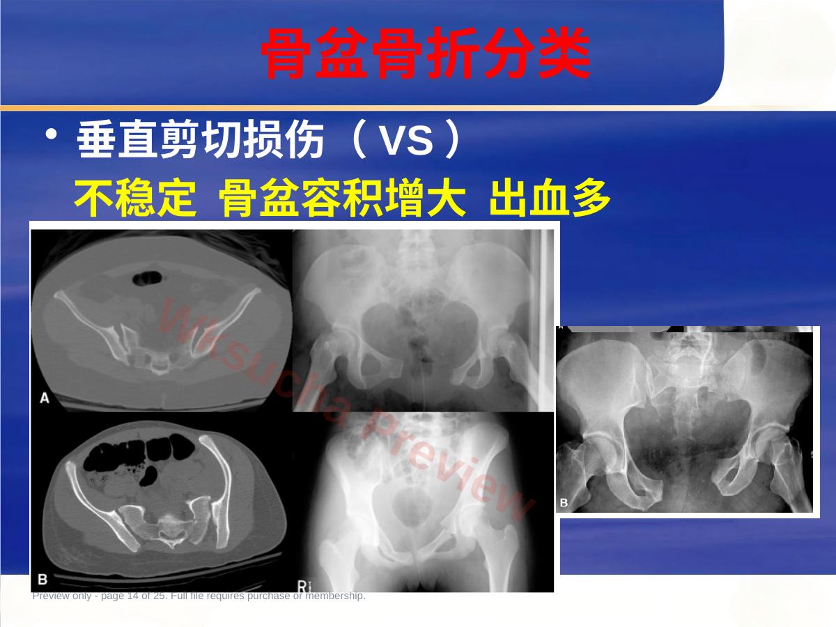 预览第 14 页