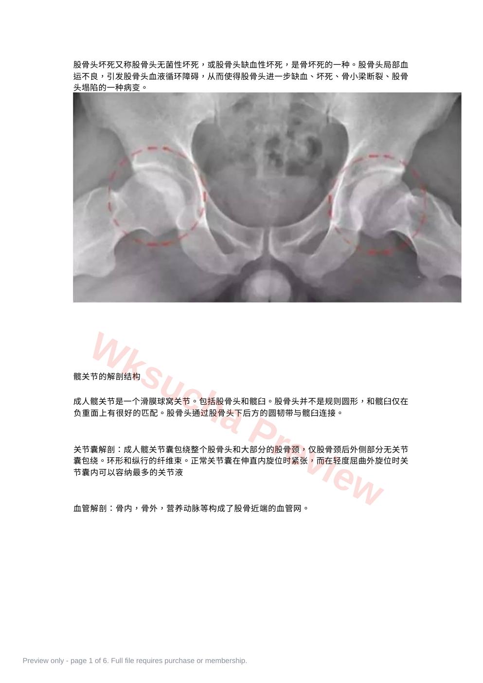 股骨头坏死的诊断与治疗策略