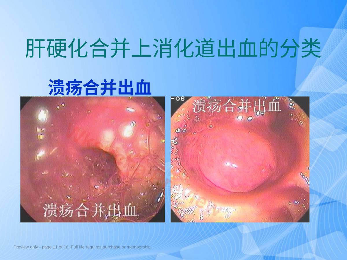 预览第 11 页
