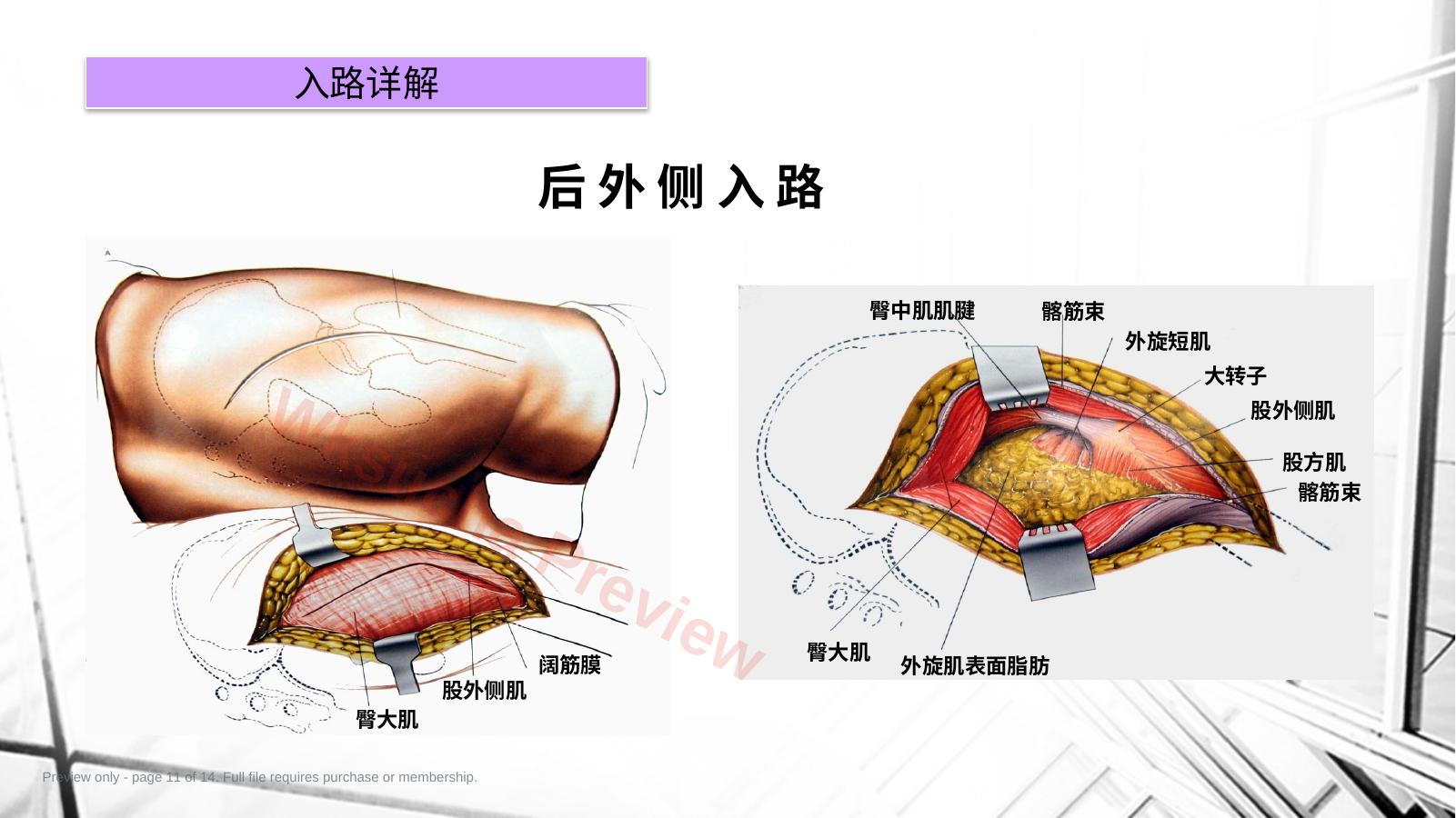 预览第 11 页
