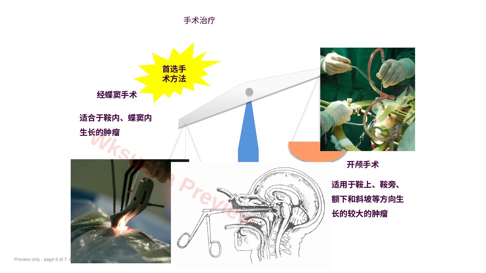 预览第 6 页