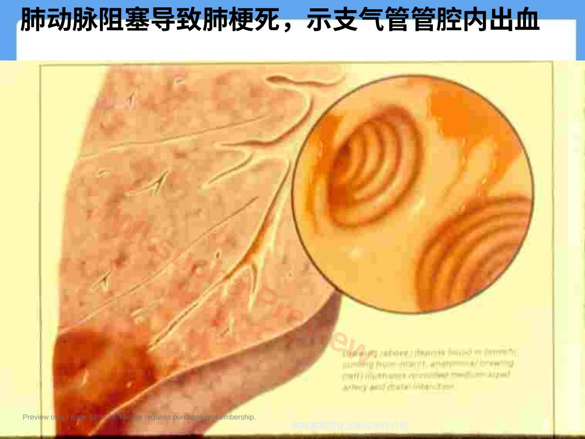 预览第 12 页