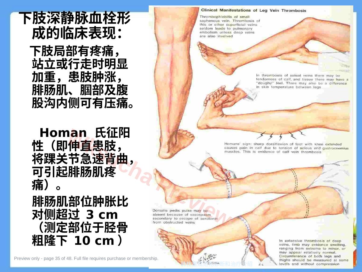 预览第 35 页