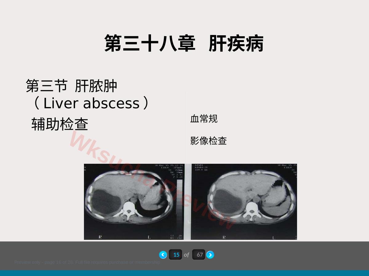 预览第 16 页