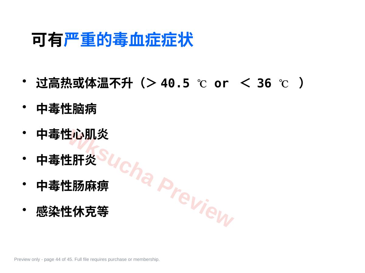 预览第 44 页