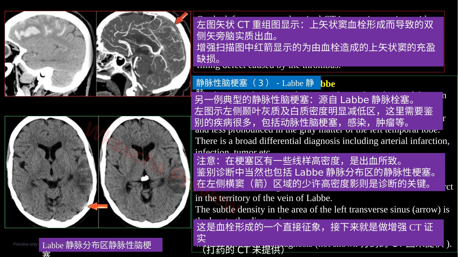 预览第 15 页