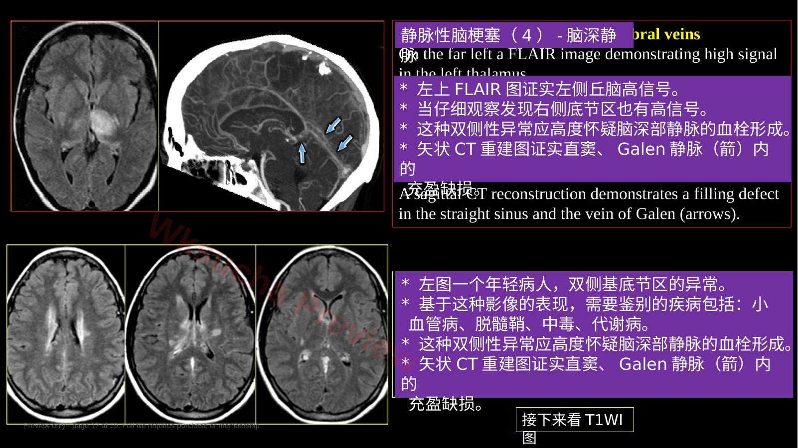 预览第 17 页