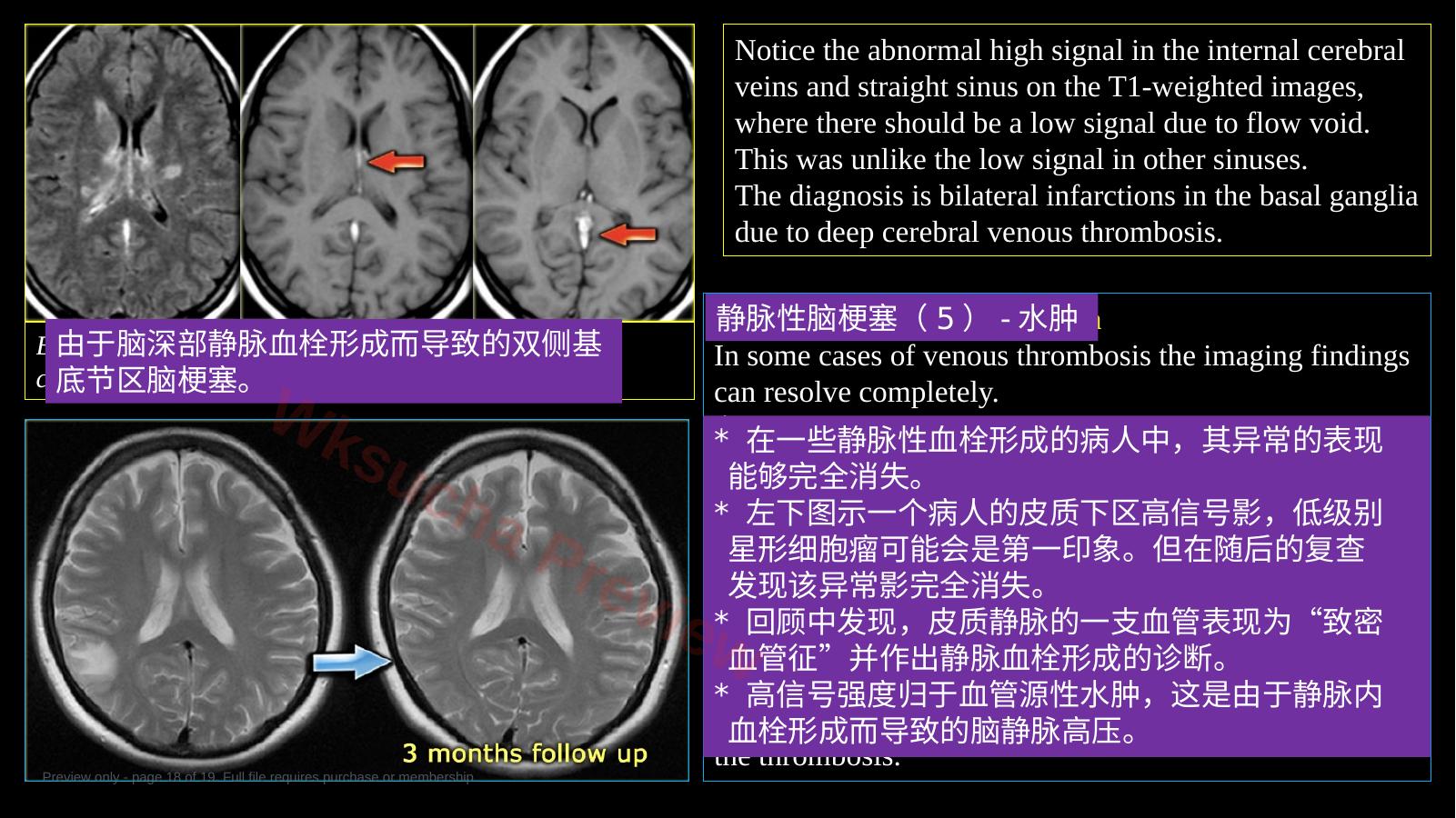 预览第 18 页