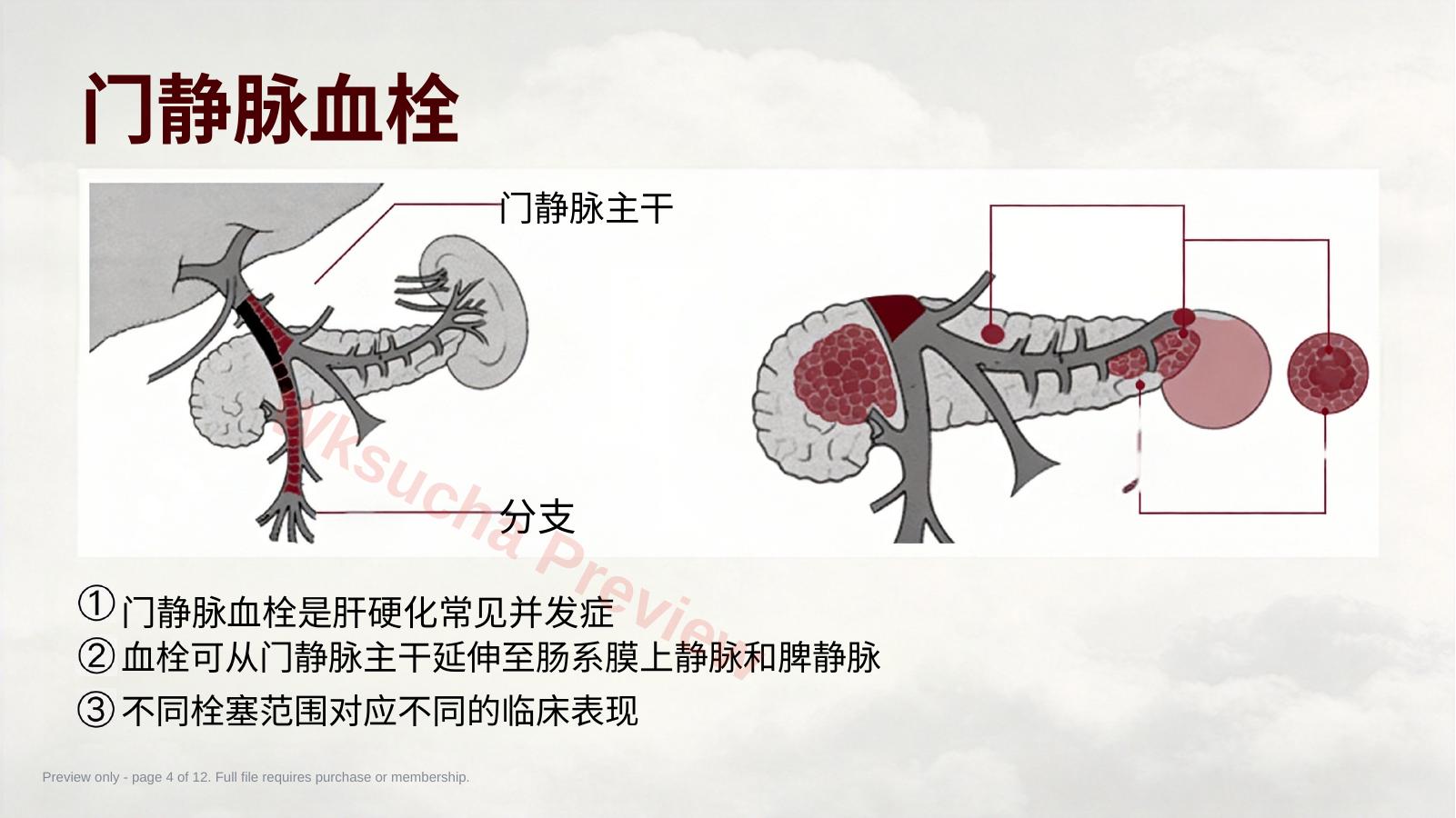预览第 4 页