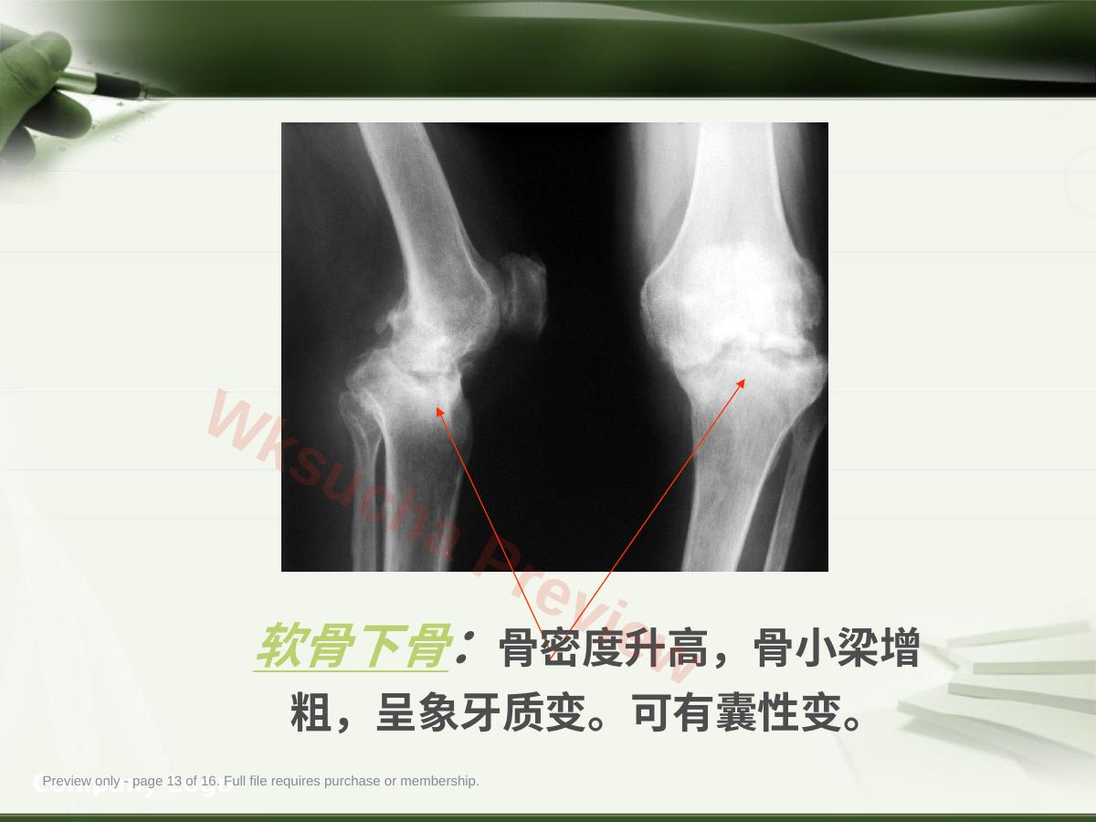 预览第 13 页