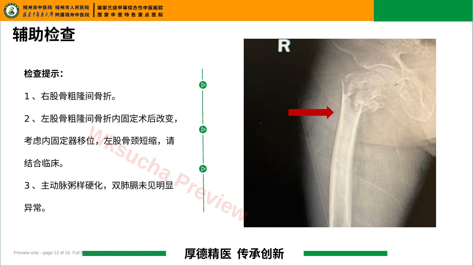 预览第 13 页