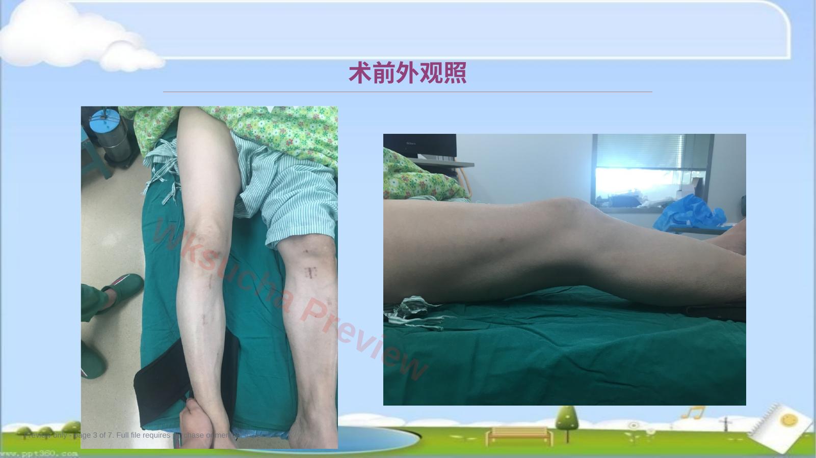 预览第 3 页
