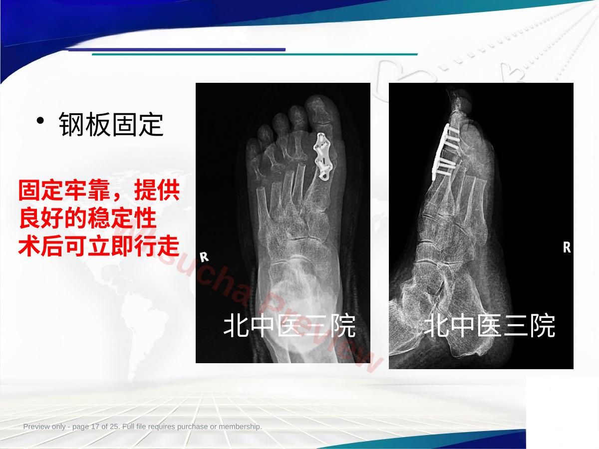 预览第 17 页