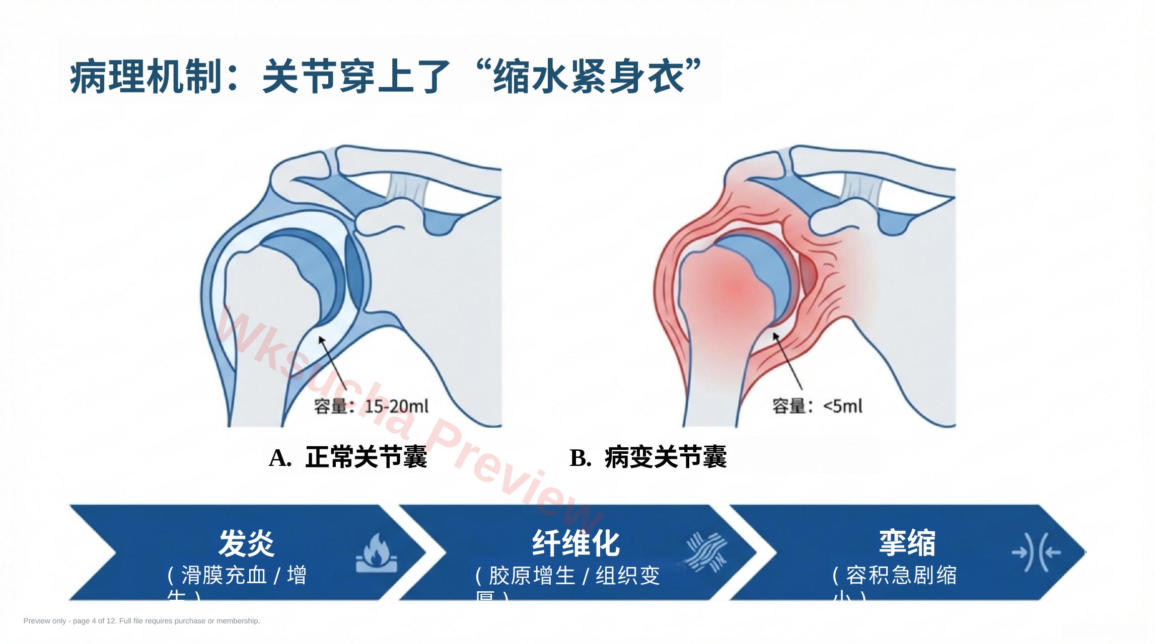 预览第 4 页