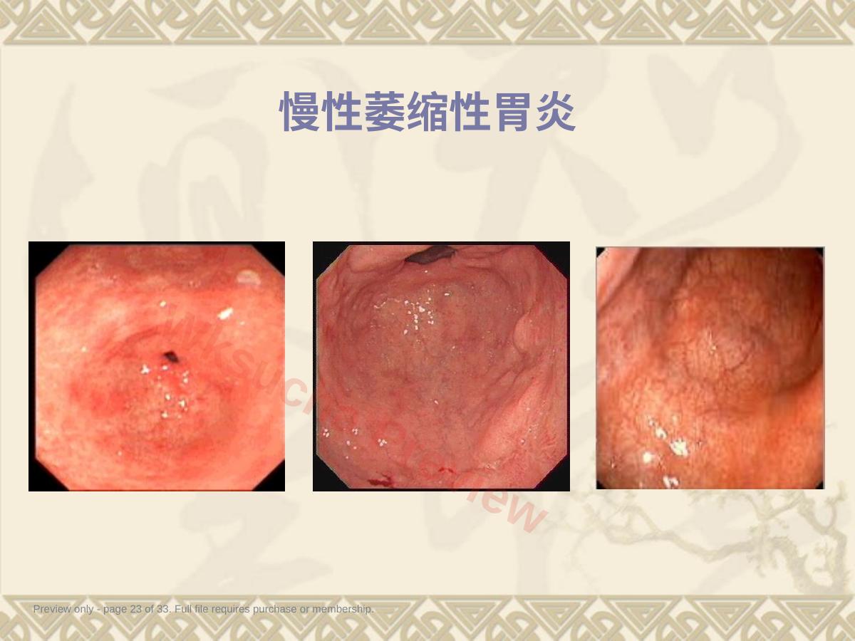 预览第 23 页