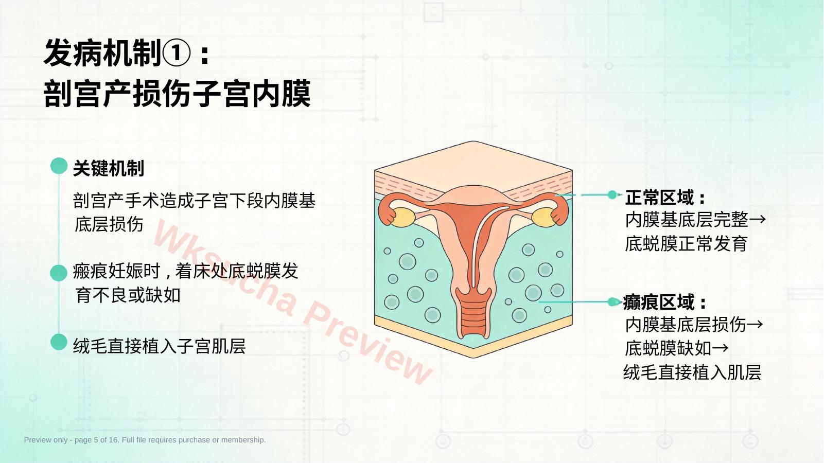 预览第 5 页