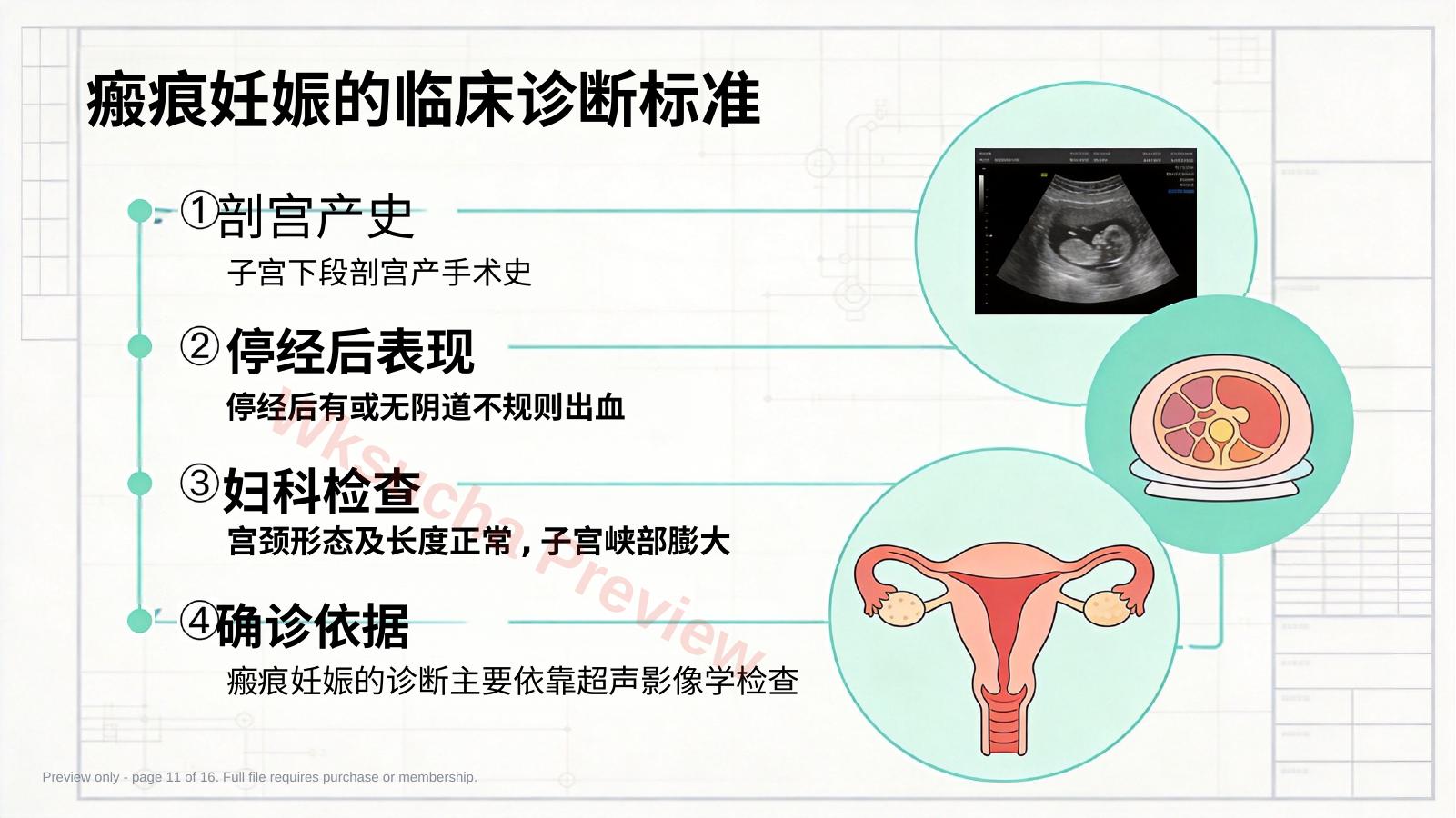 预览第 11 页