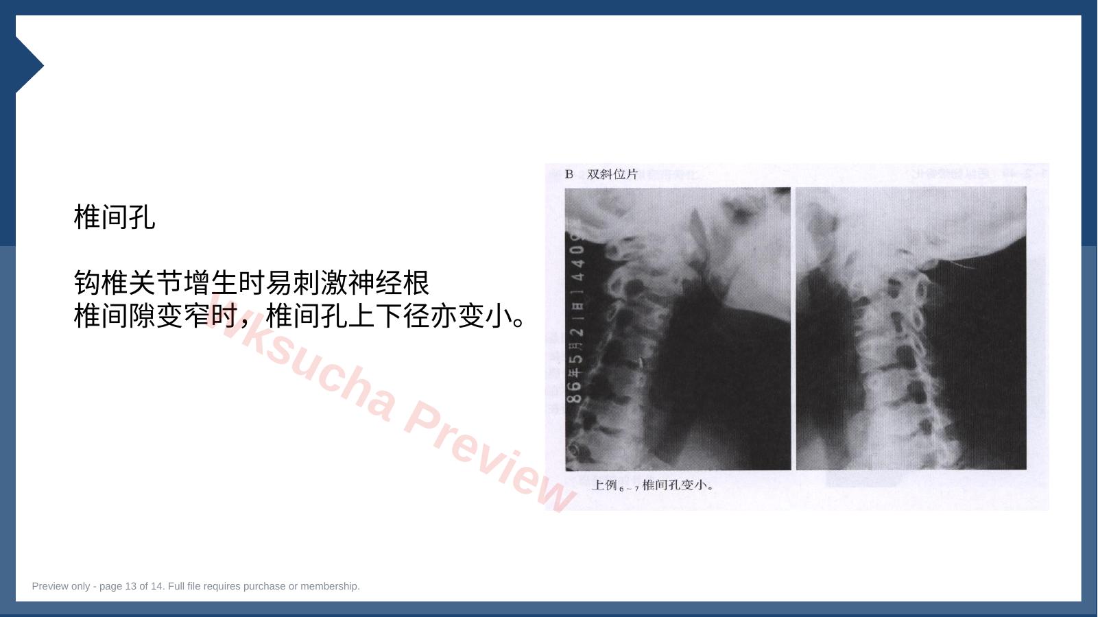 预览第 13 页